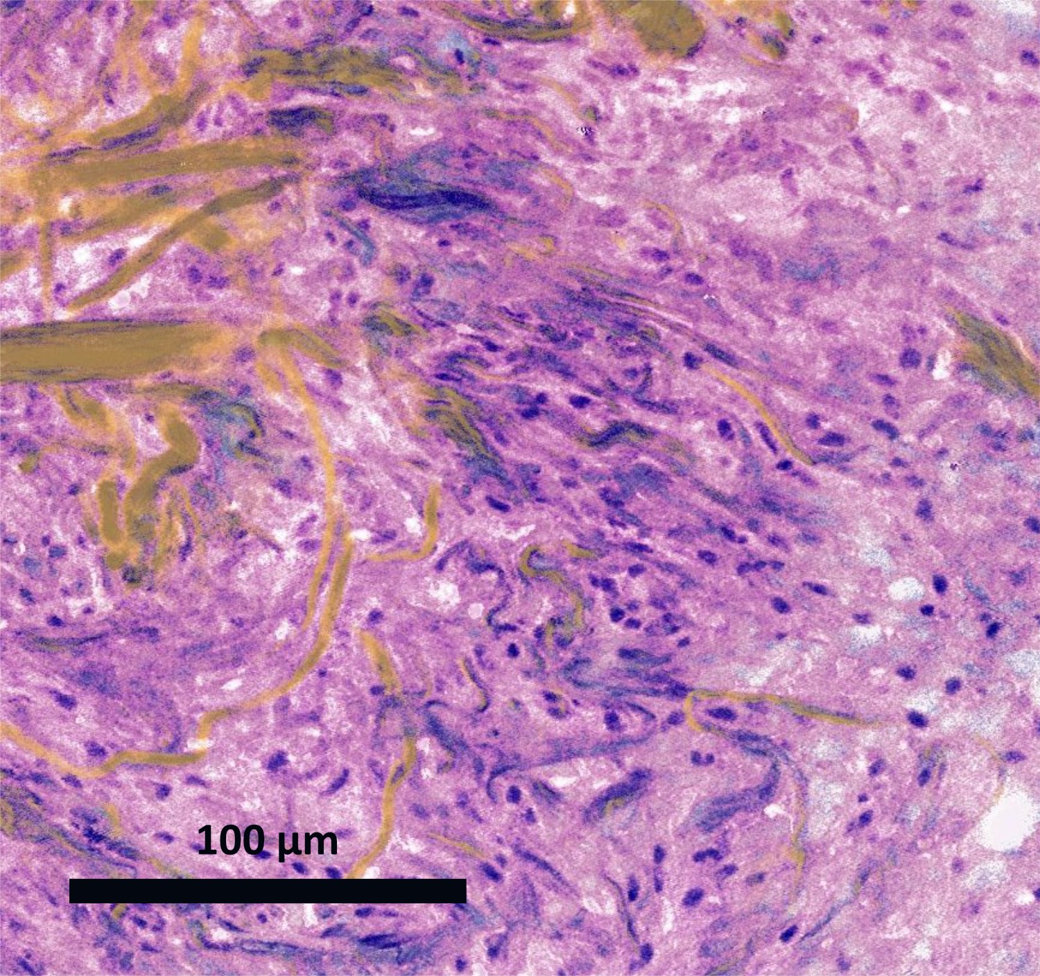 Stimulated Raman histology detail, roughly 100 micrometer field of view