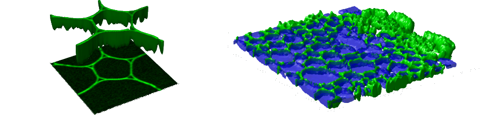 Stimulated Raman scattering microscopy visualization